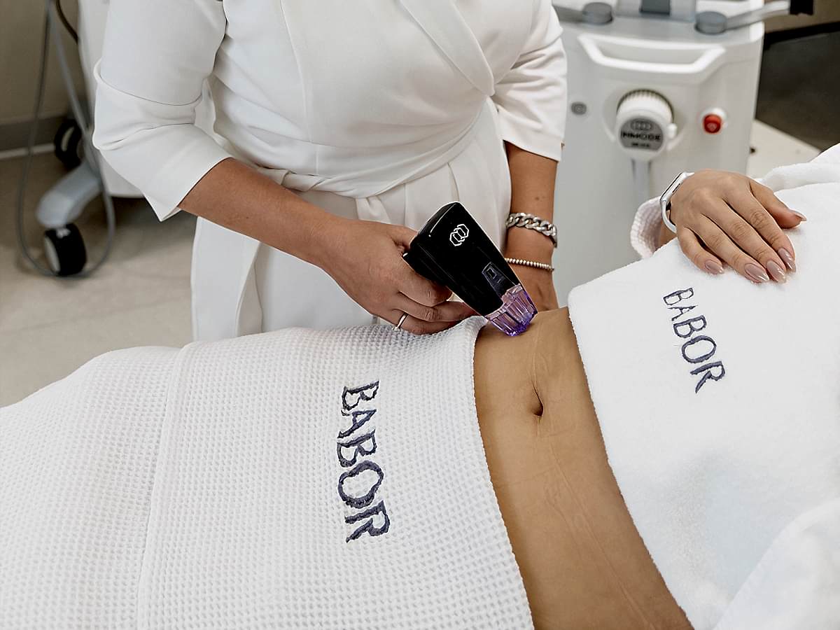 Игольчатый RF (Живот)