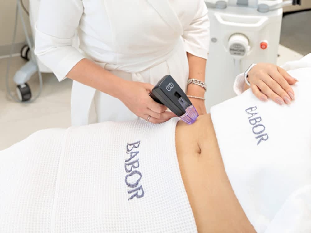 Игольчатый RF (Живот)